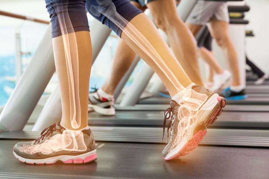 Quelles activités physiques pour une bonne santé osseuse ?